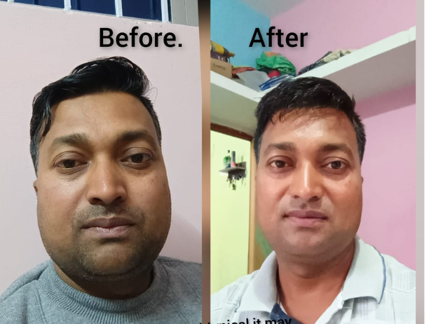 Transform Your Body Without the Gym: Join Darshana’s Nutrition Plan